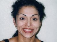 After Lipliner and Eyebrow PMU