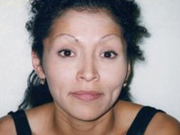Before Lipliner and Eyebrow PMU